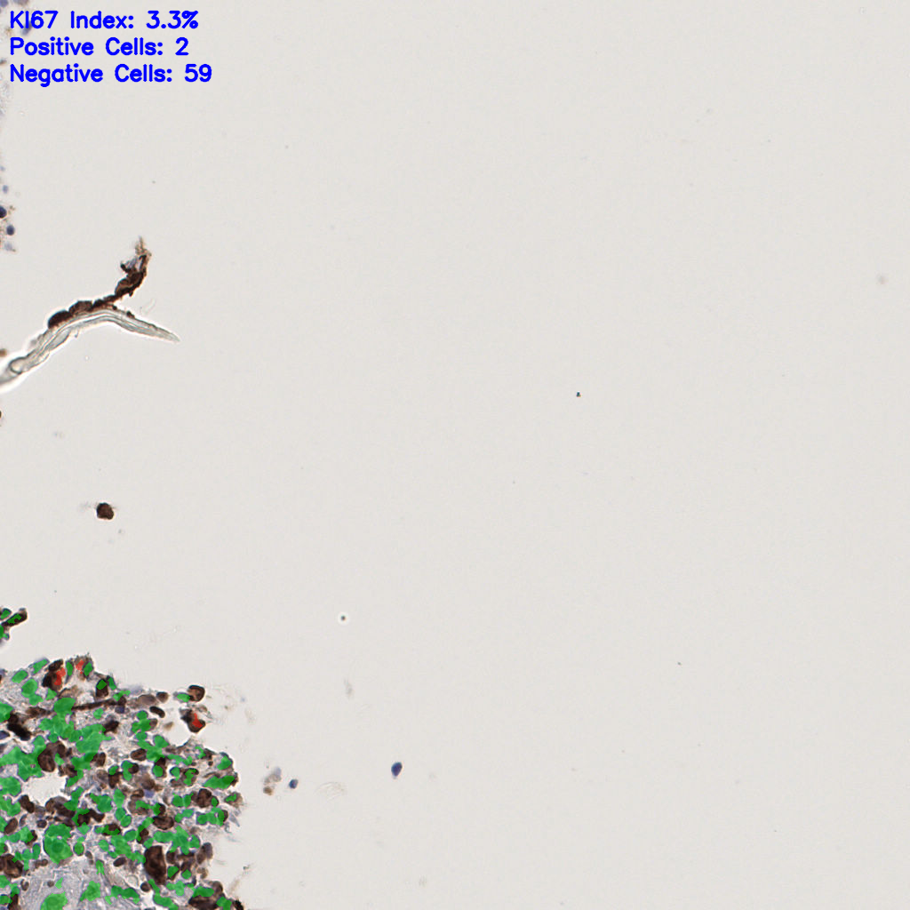 slice_55_17_x49280_y15232.png