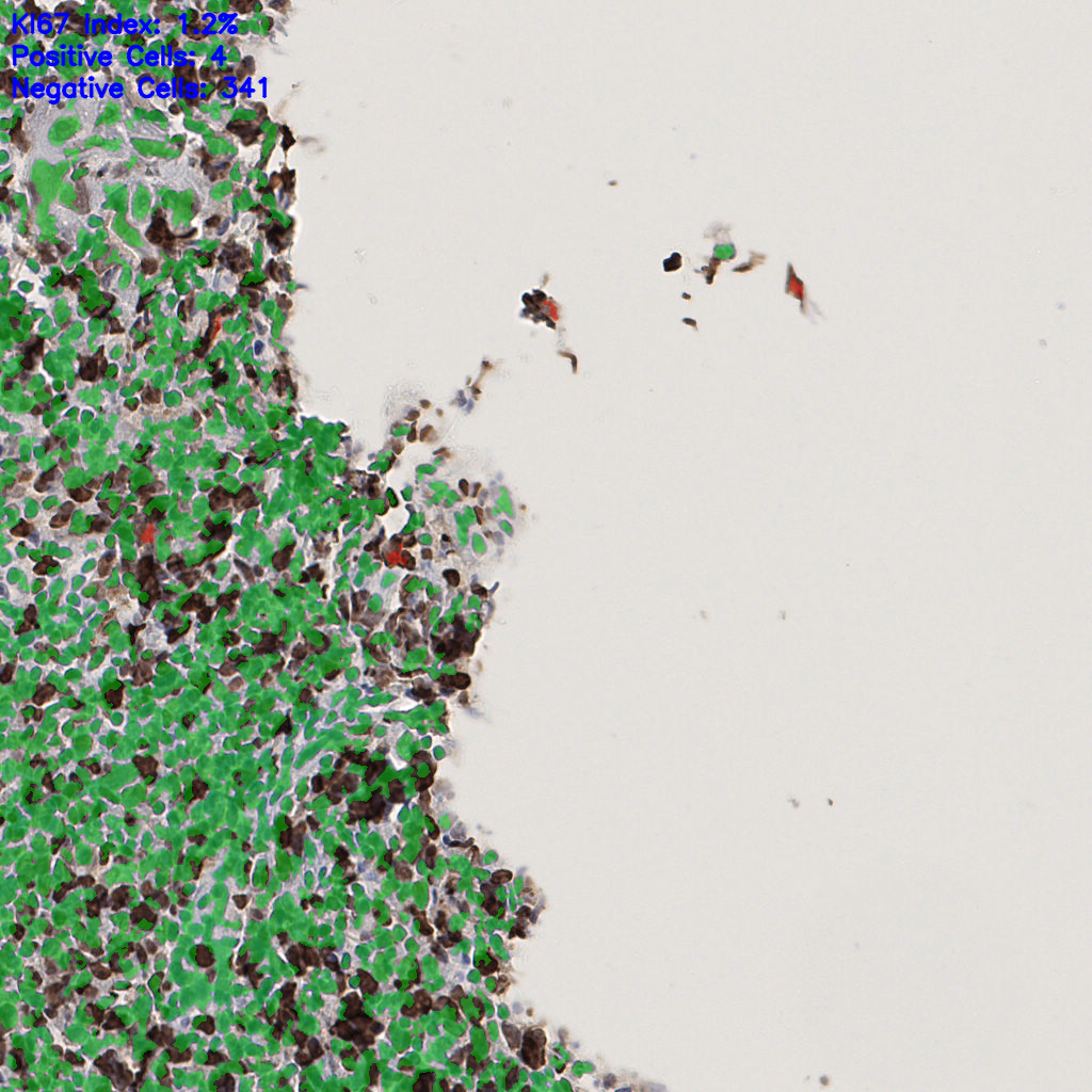 slice_55_18_x49280_y16128.png