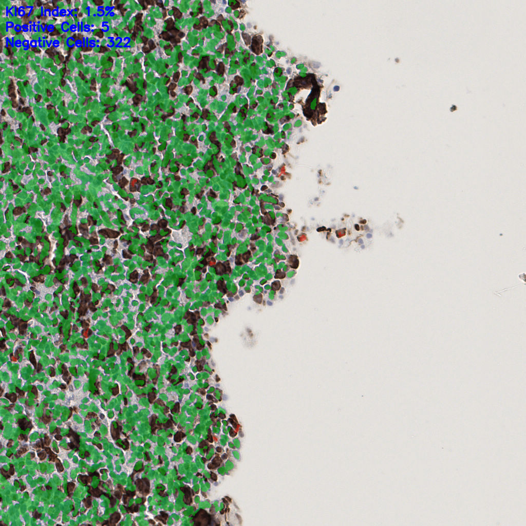 slice_55_19_x49280_y17024.png