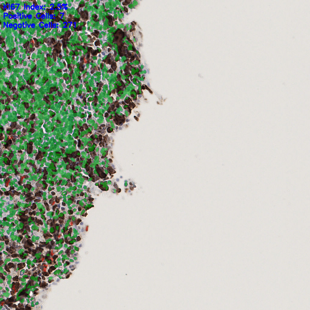 slice_55_20_x49280_y17920.png