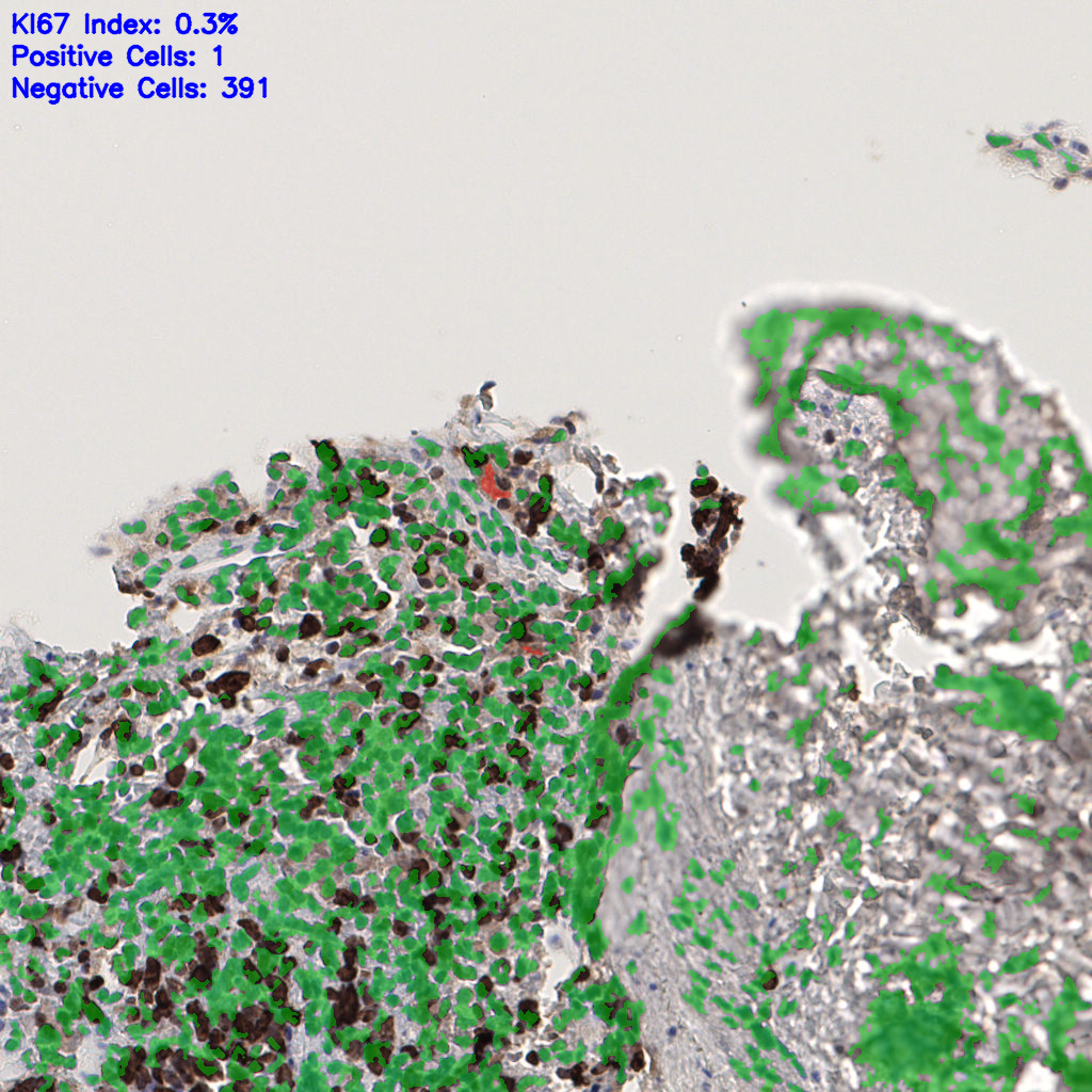 slice_55_2_x49280_y1792.png