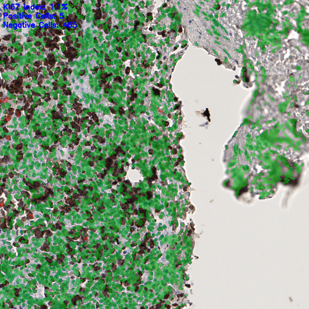 slice_55_3_x49280_y2688.png
