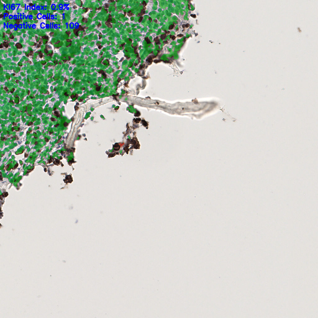 slice_55_4_x49280_y3584.png
