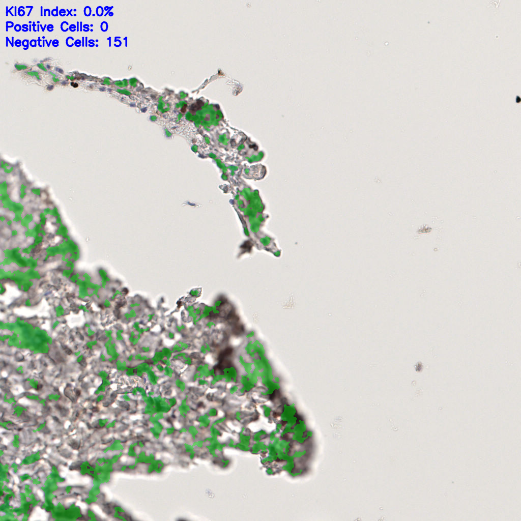 slice_56_2_x50176_y1792.png