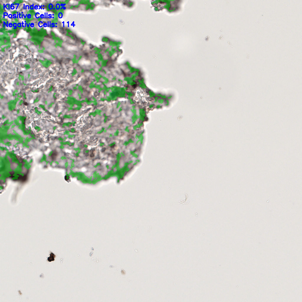 slice_56_3_x50176_y2688.png