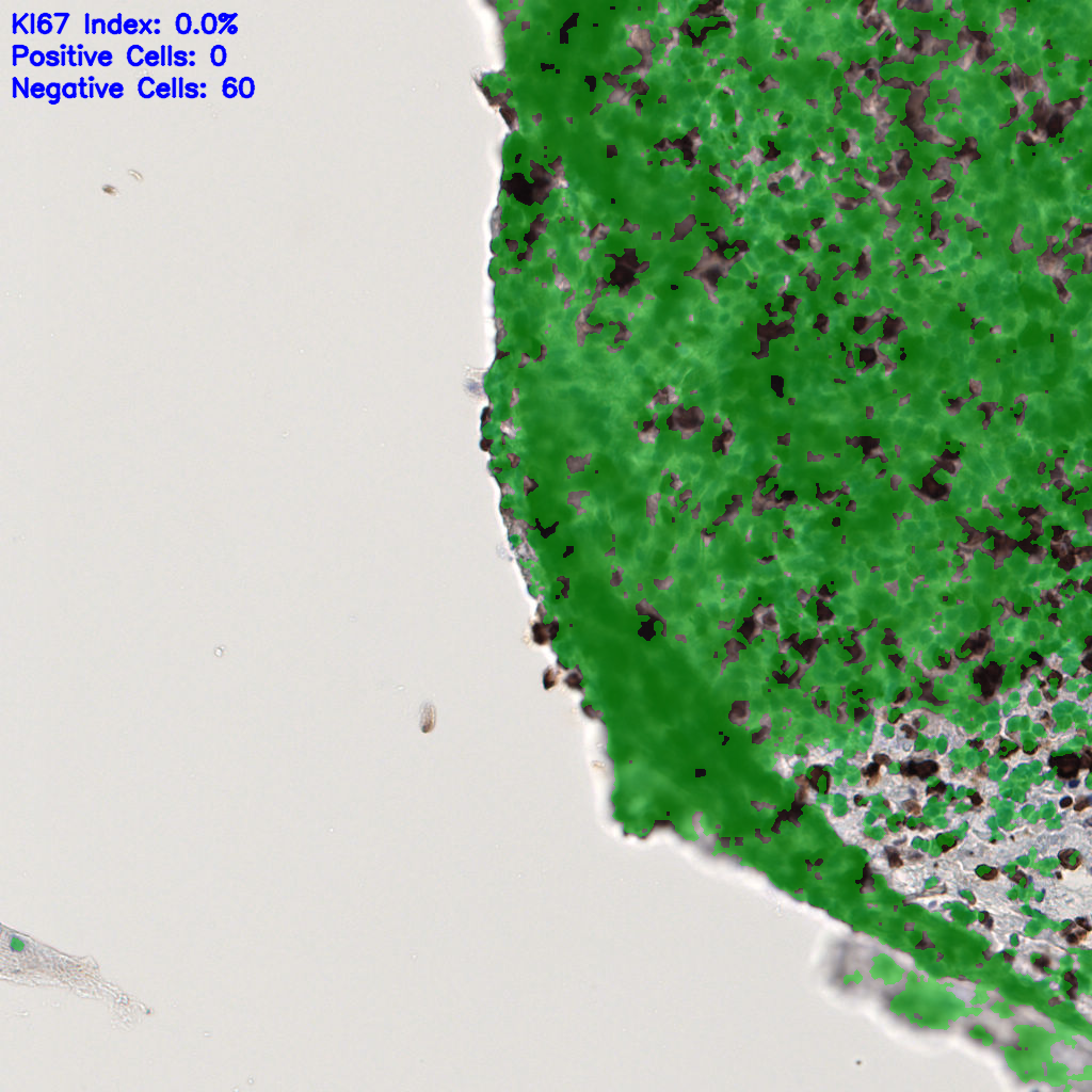 slice_56_9_x50176_y8064.png