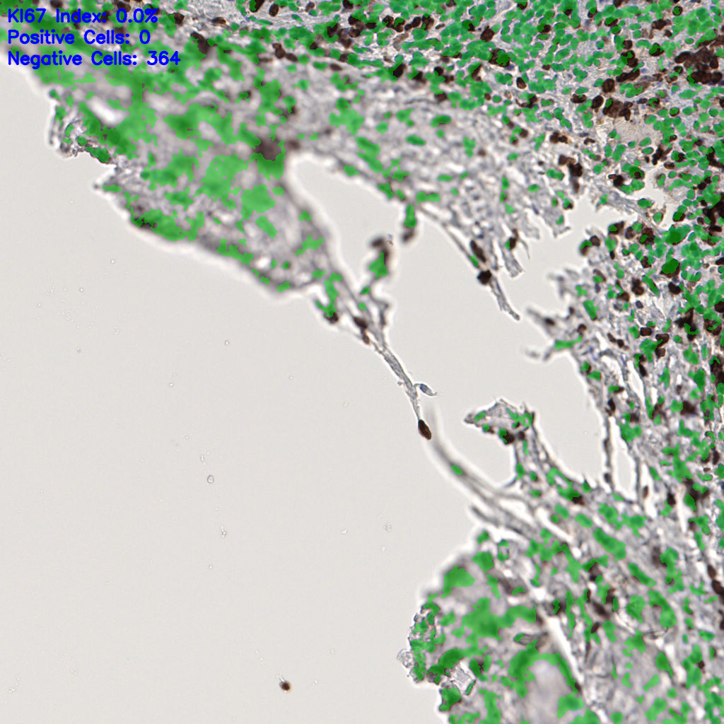 slice_57_10_x51072_y8960.png