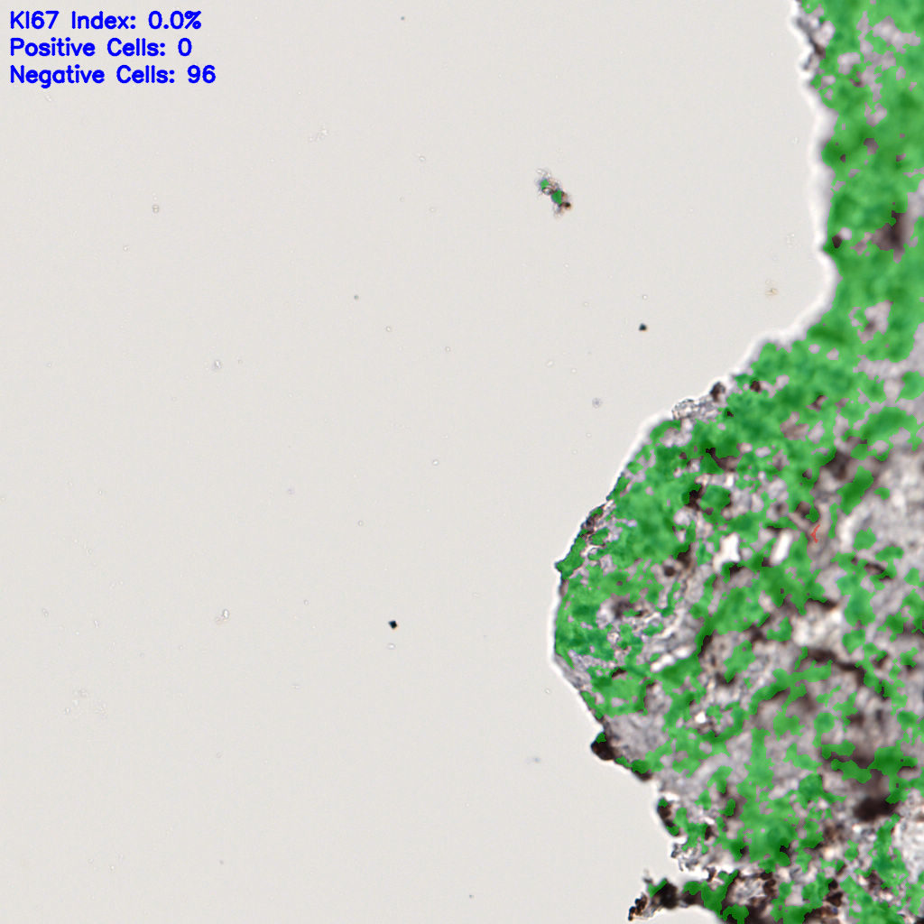 slice_57_12_x51072_y10752.png