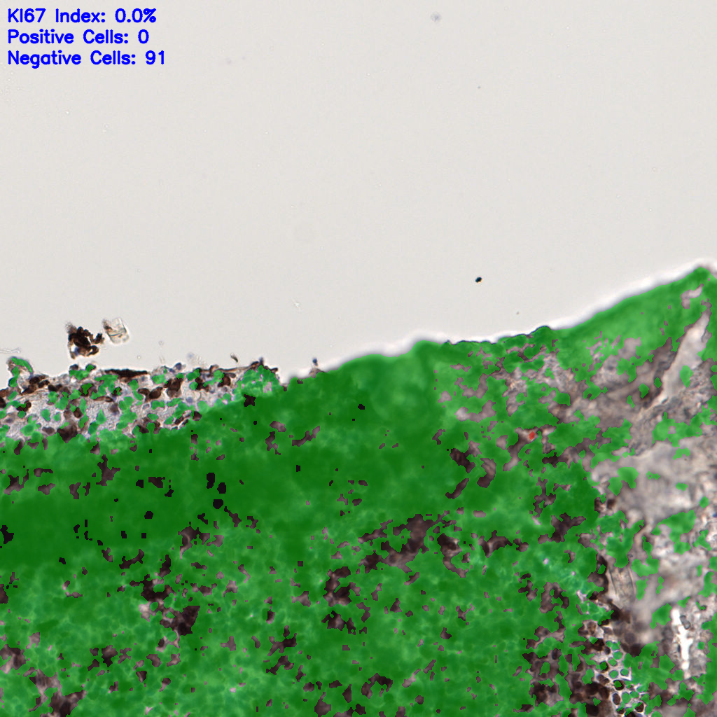 slice_57_8_x51072_y7168.png