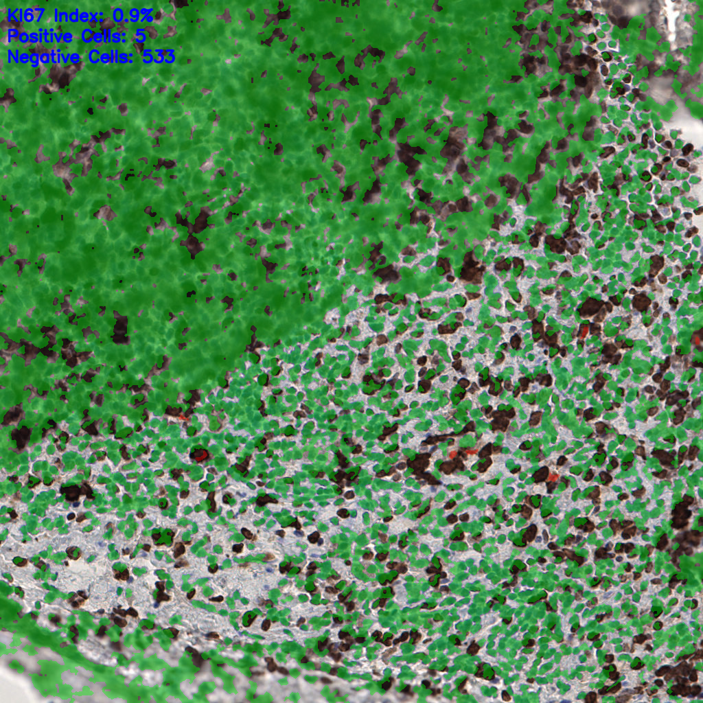 slice_57_9_x51072_y8064.png