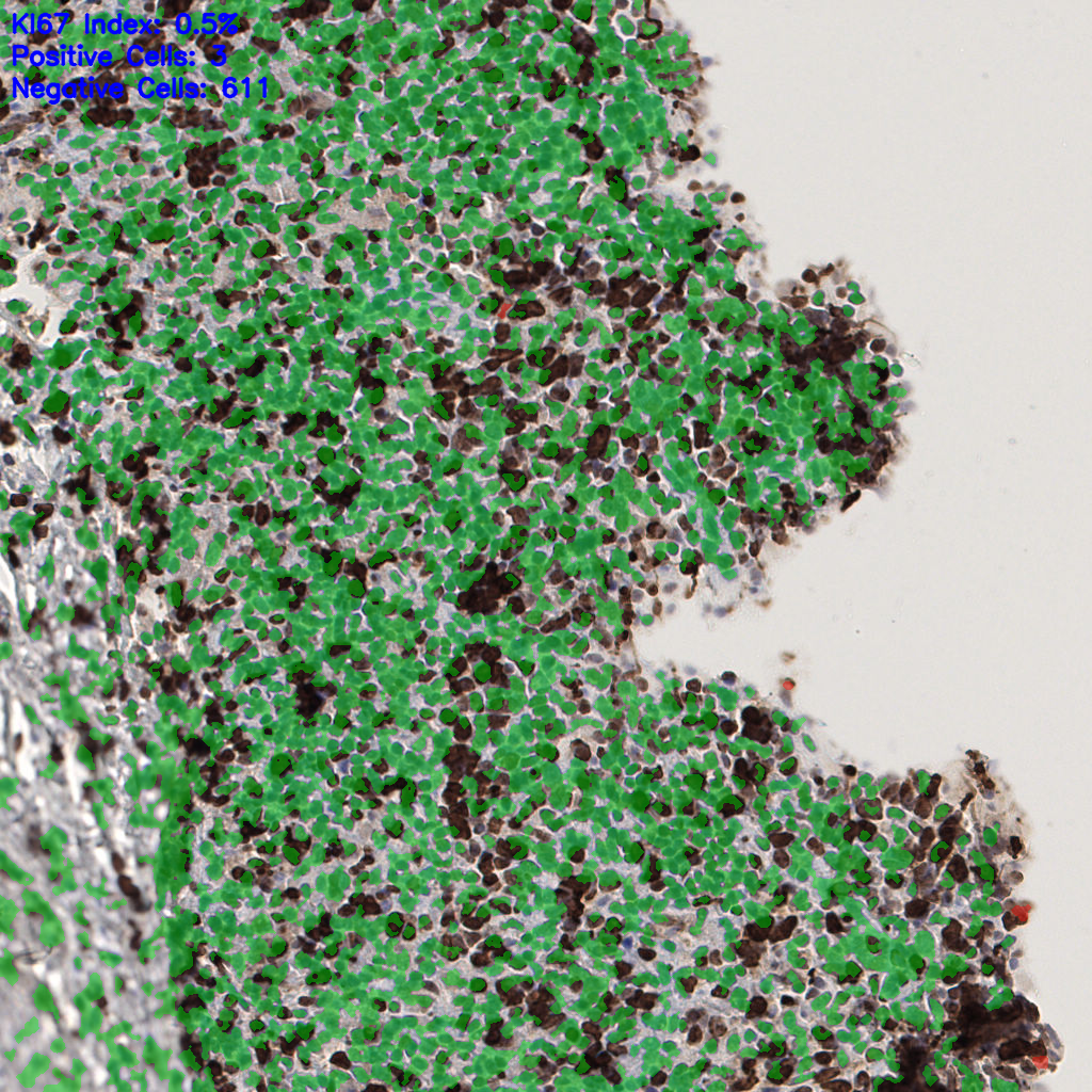 slice_58_10_x51968_y8960.png