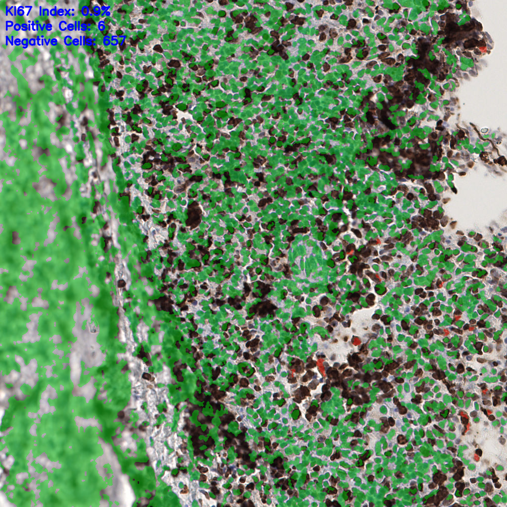 slice_58_11_x51968_y9856.png
