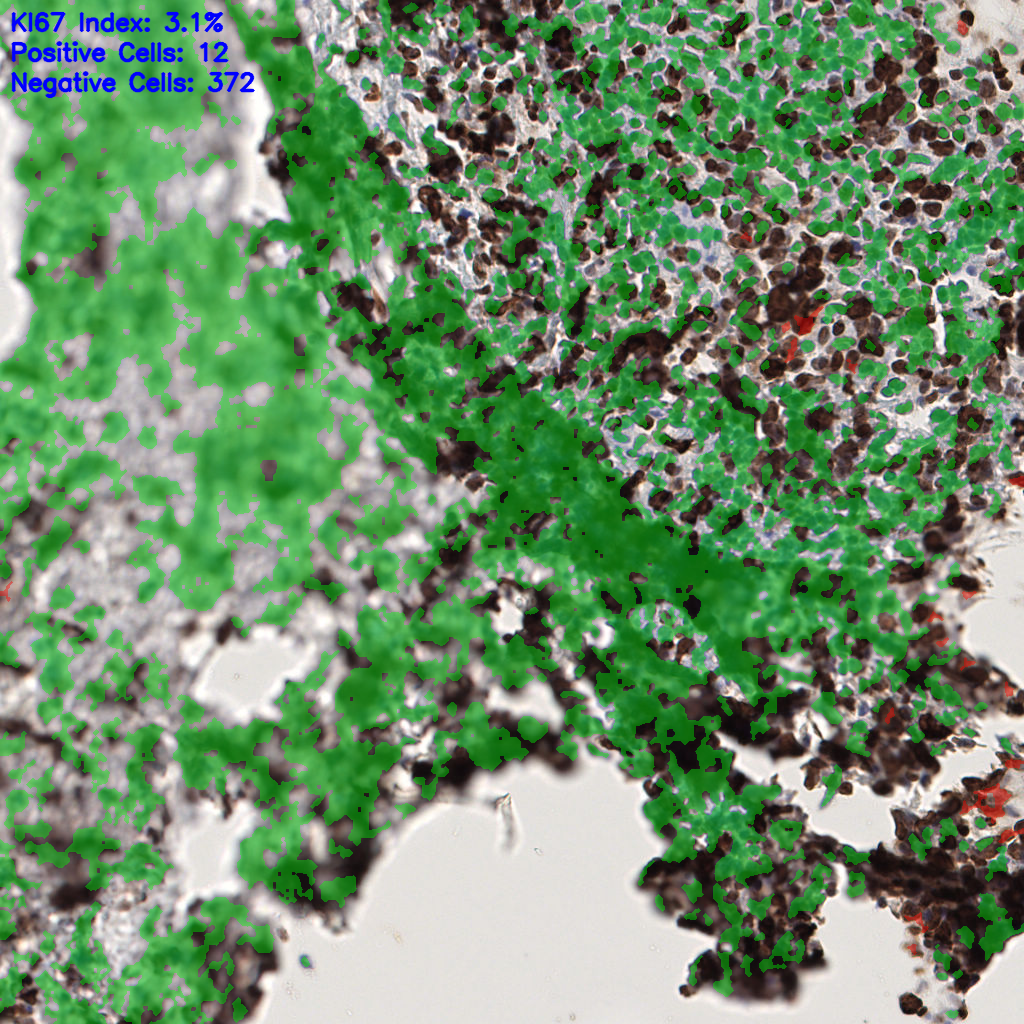 slice_58_12_x51968_y10752.png