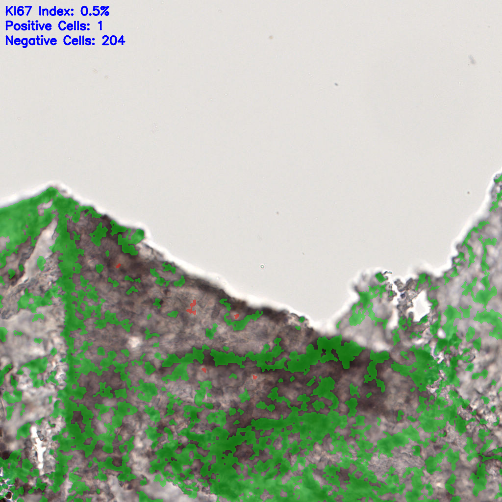 slice_58_8_x51968_y7168.png
