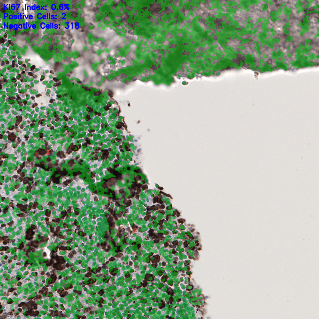 slice_58_9_x51968_y8064.png