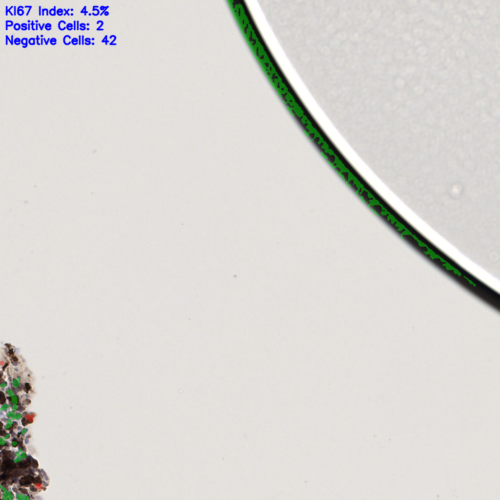 slice_59_10_x52864_y8960.png