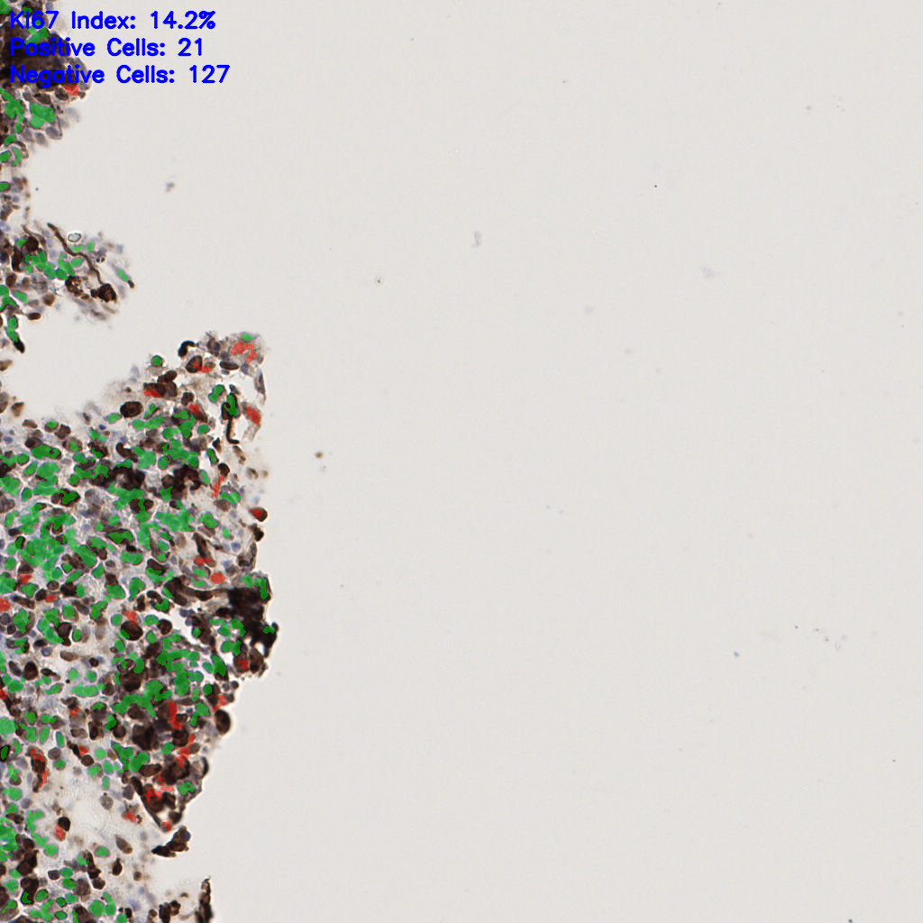 slice_59_11_x52864_y9856.png