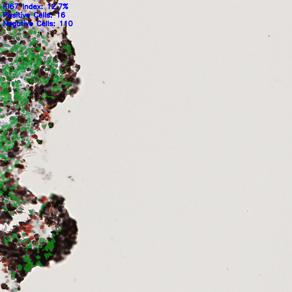 slice_59_12_x52864_y10752.png