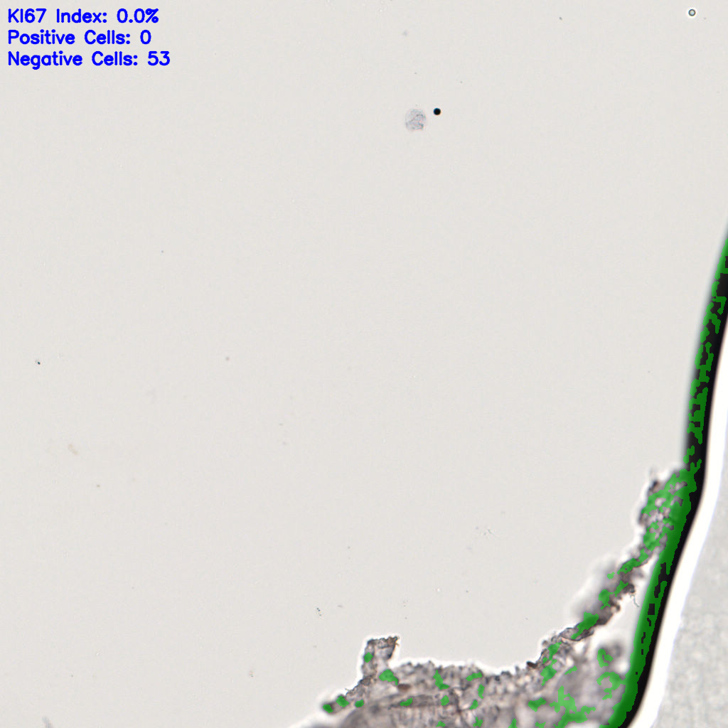 slice_59_7_x52864_y6272.png