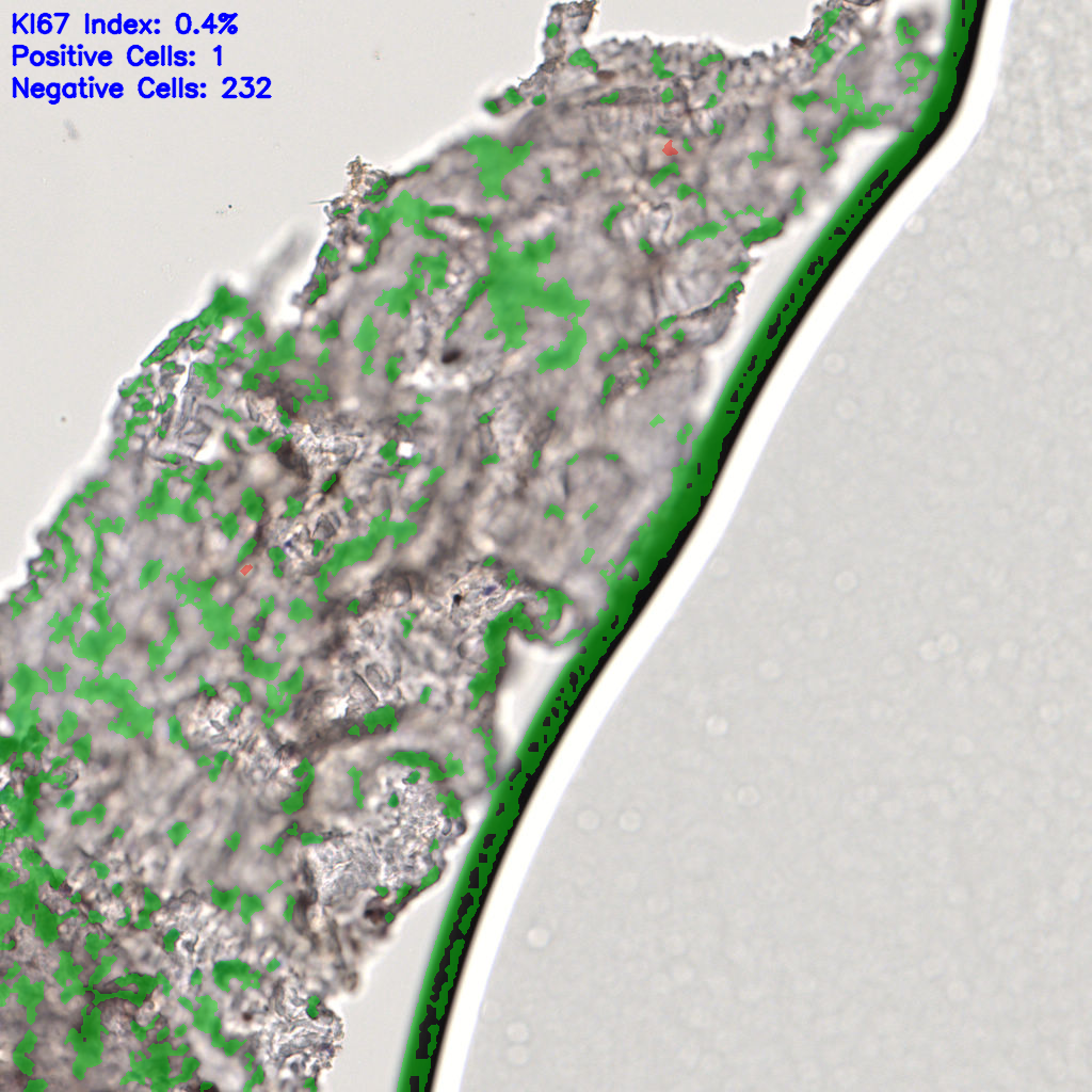 slice_59_8_x52864_y7168.png