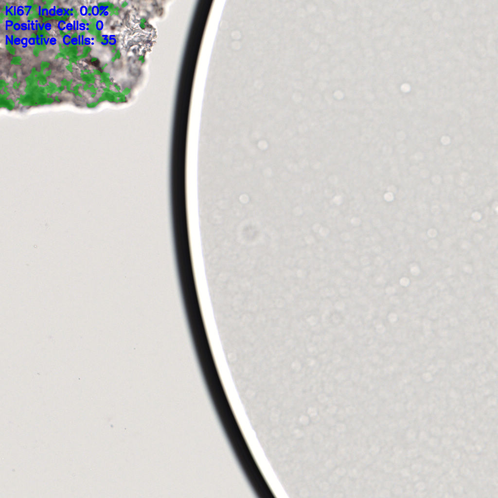 slice_59_9_x52864_y8064.png