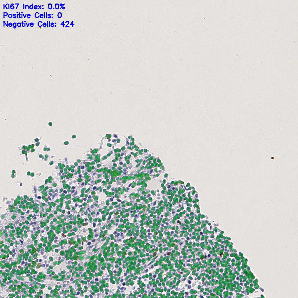 slice_5_10_x4480_y8960.png