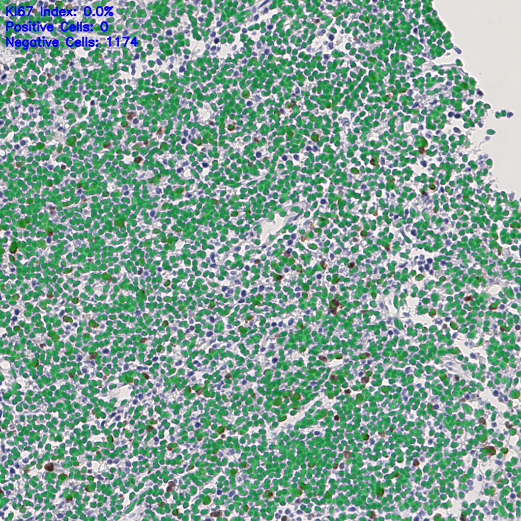 slice_5_11_x4480_y9856.png