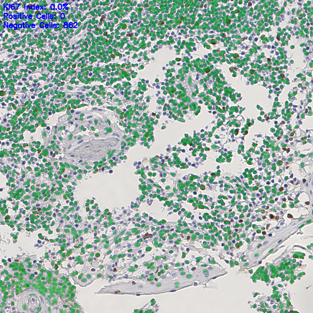 slice_5_12_x4480_y10752.png