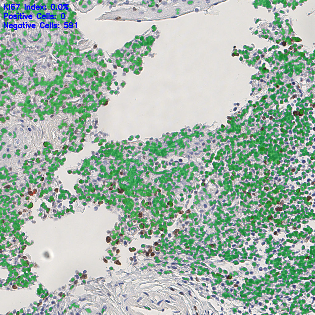 slice_5_13_x4480_y11648.png