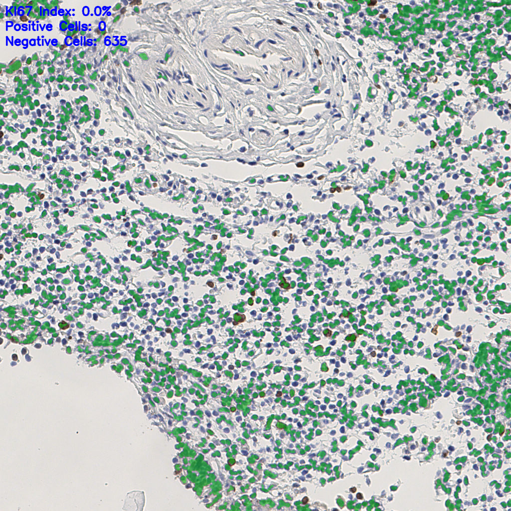slice_5_14_x4480_y12544.png