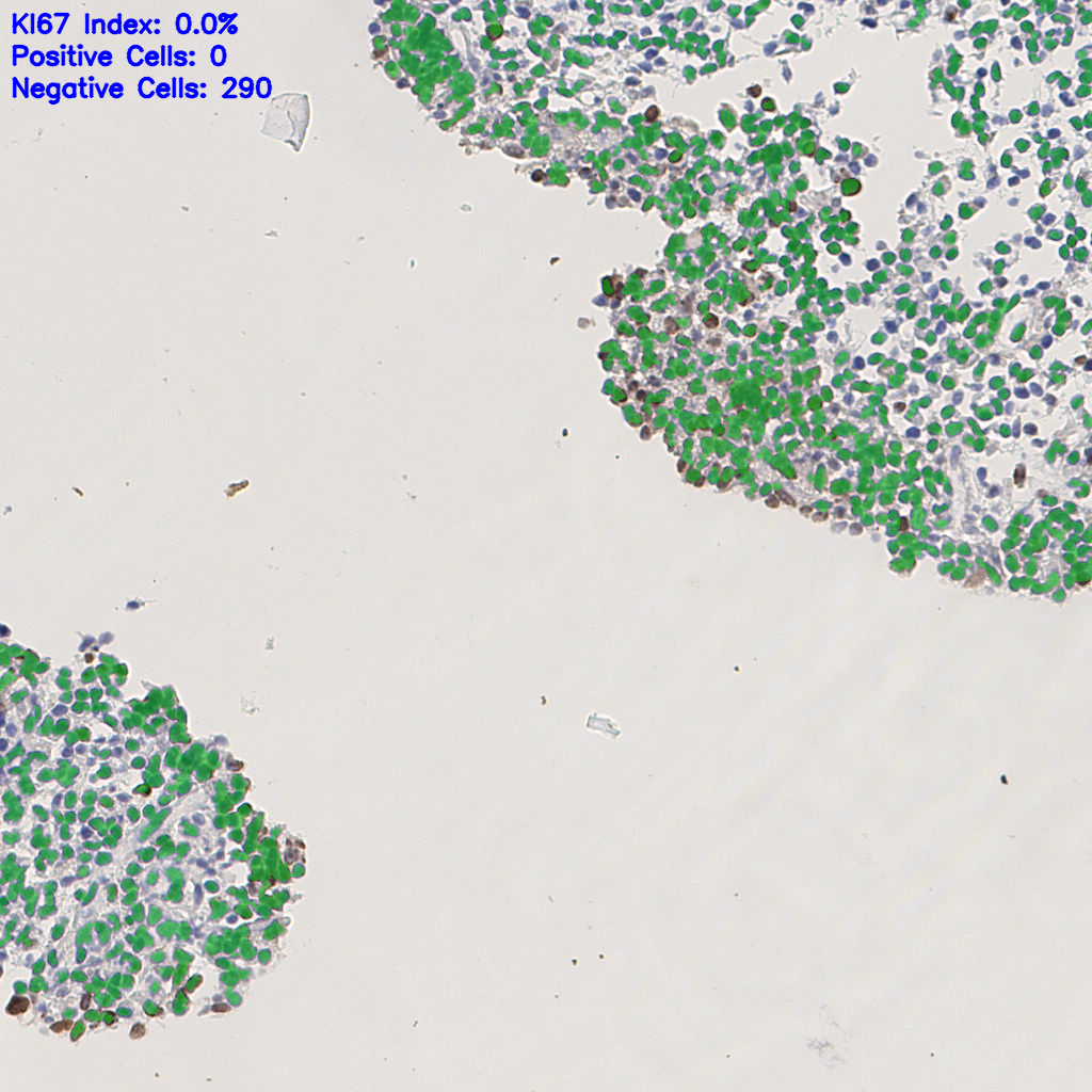 slice_5_15_x4480_y13440.png