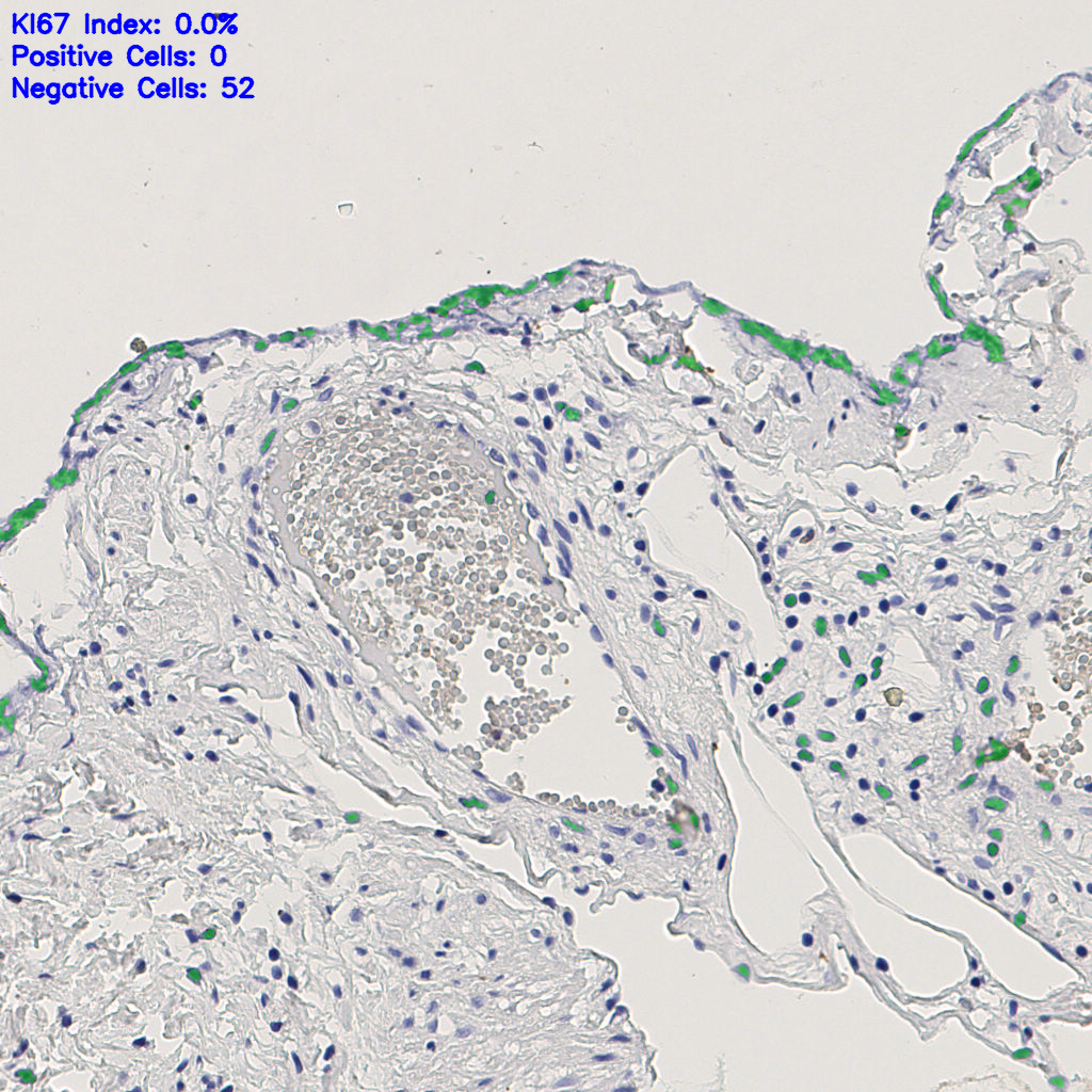 slice_5_19_x4480_y17024.png