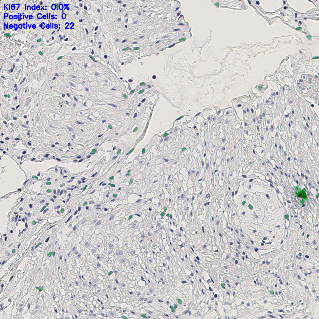 slice_5_20_x4480_y17920.png