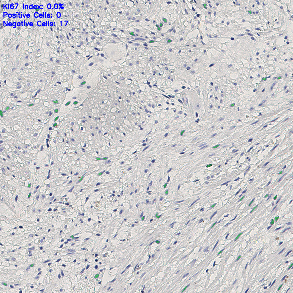 slice_5_21_x4480_y18816.png