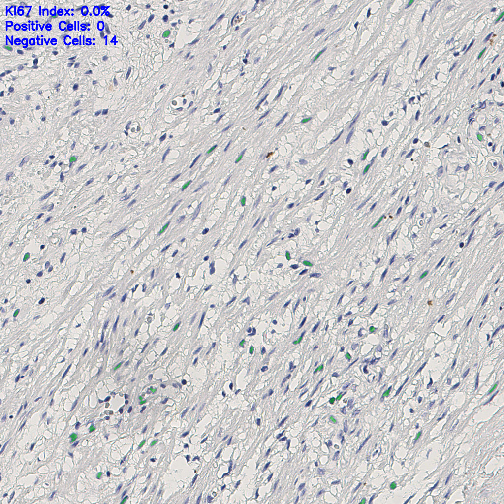 slice_5_22_x4480_y19712.png
