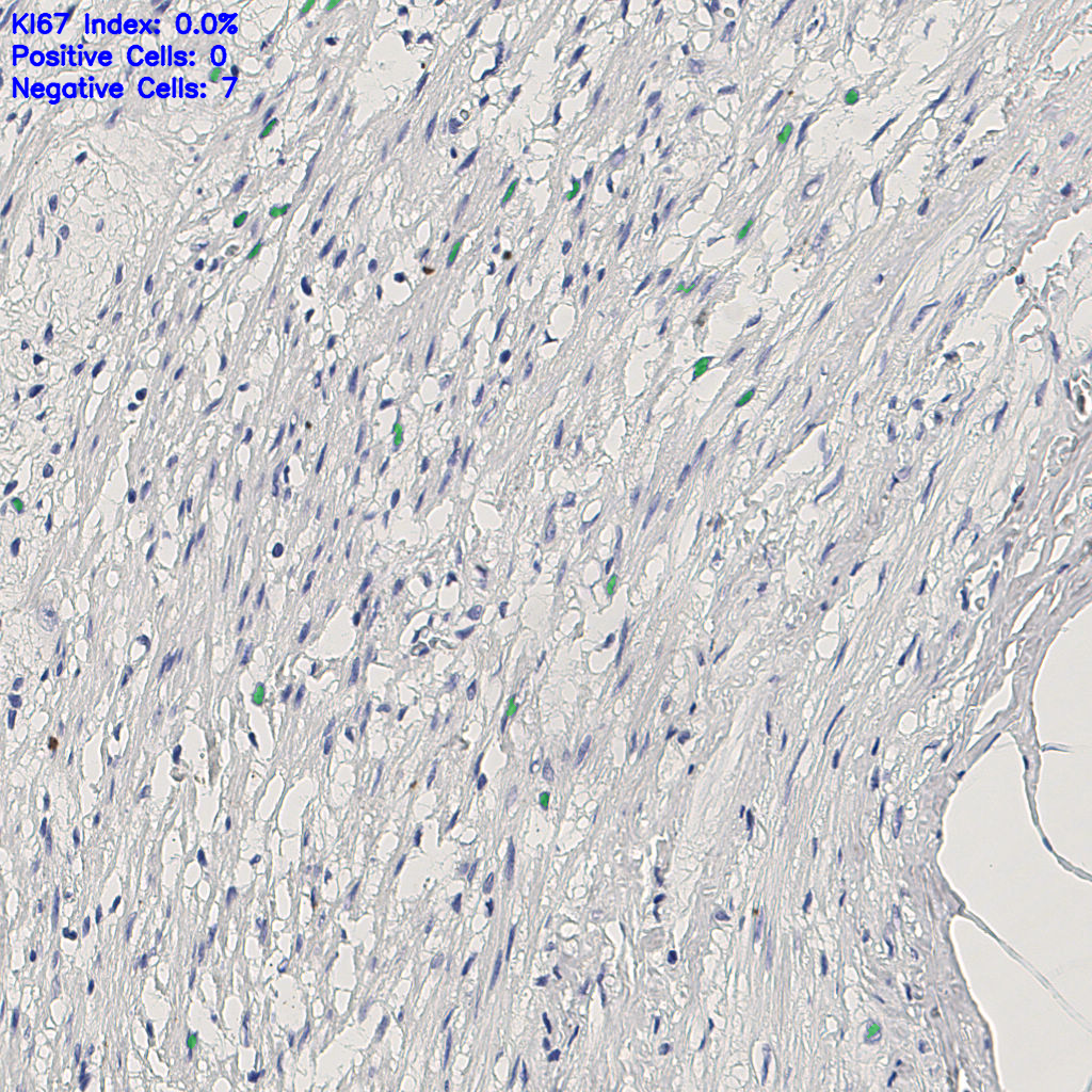 slice_5_23_x4480_y20608.png