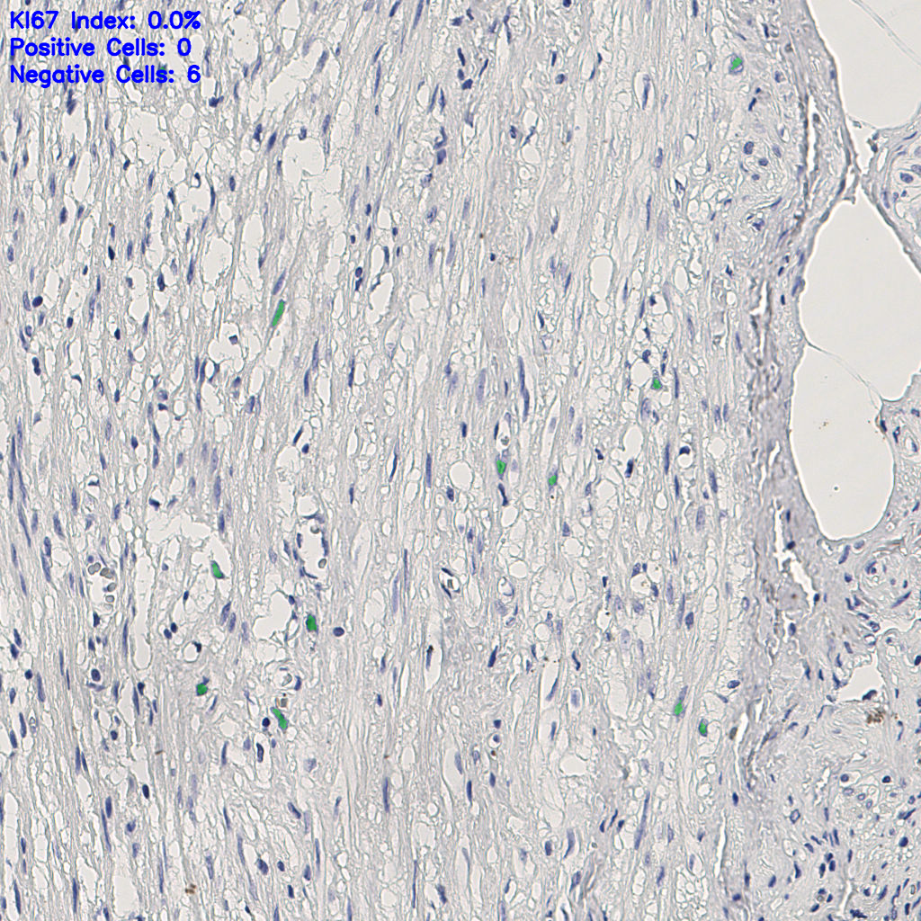 slice_5_24_x4480_y21504.png
