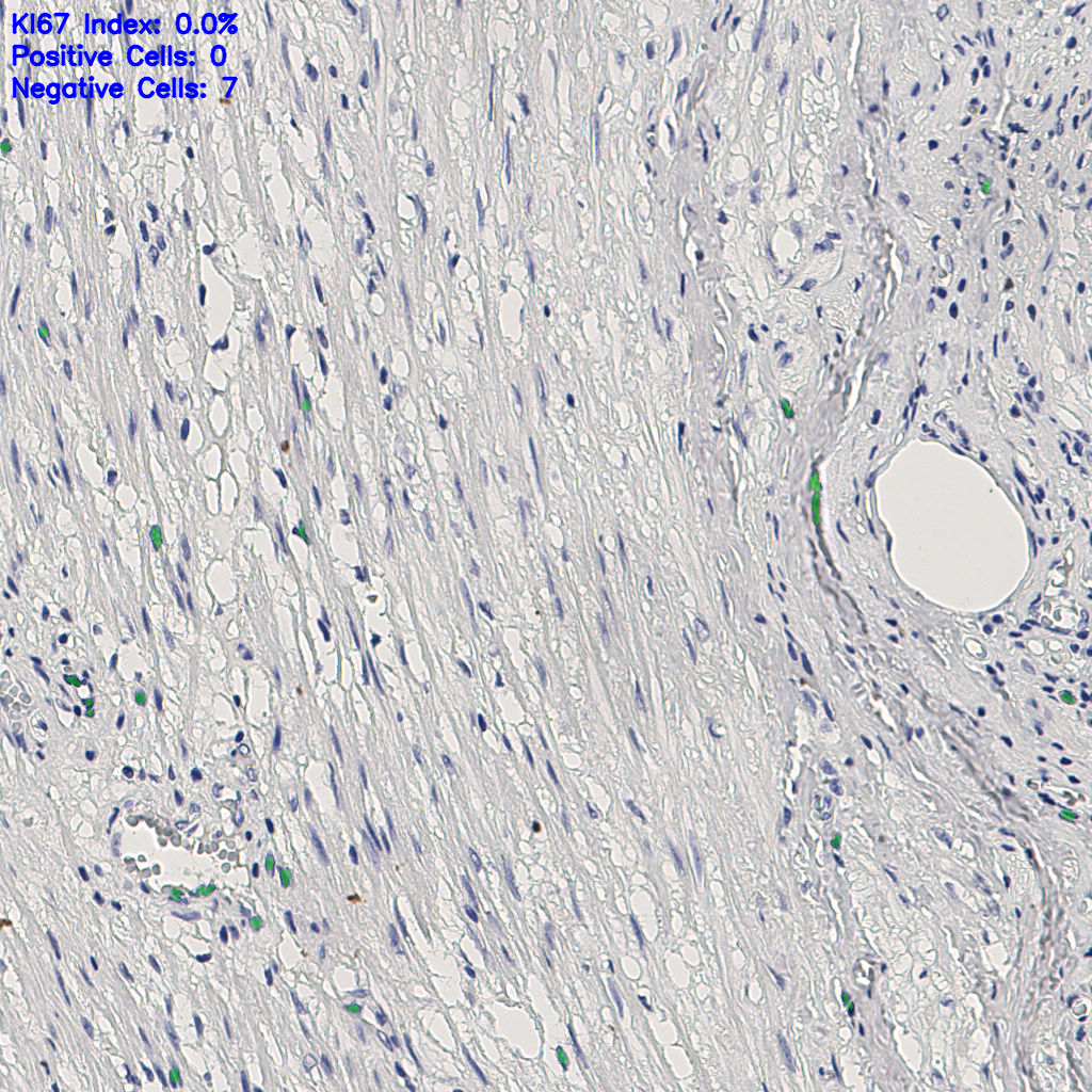 slice_5_25_x4480_y22400.png