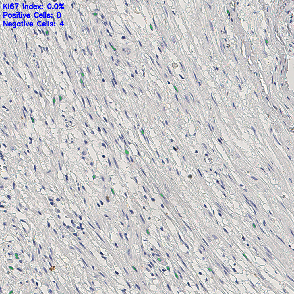 slice_5_26_x4480_y23296.png