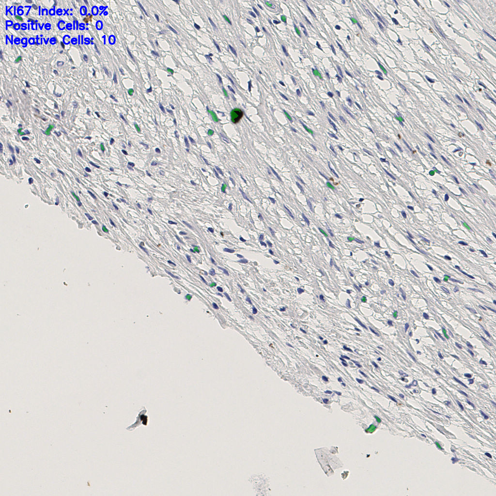 slice_5_27_x4480_y24192.png