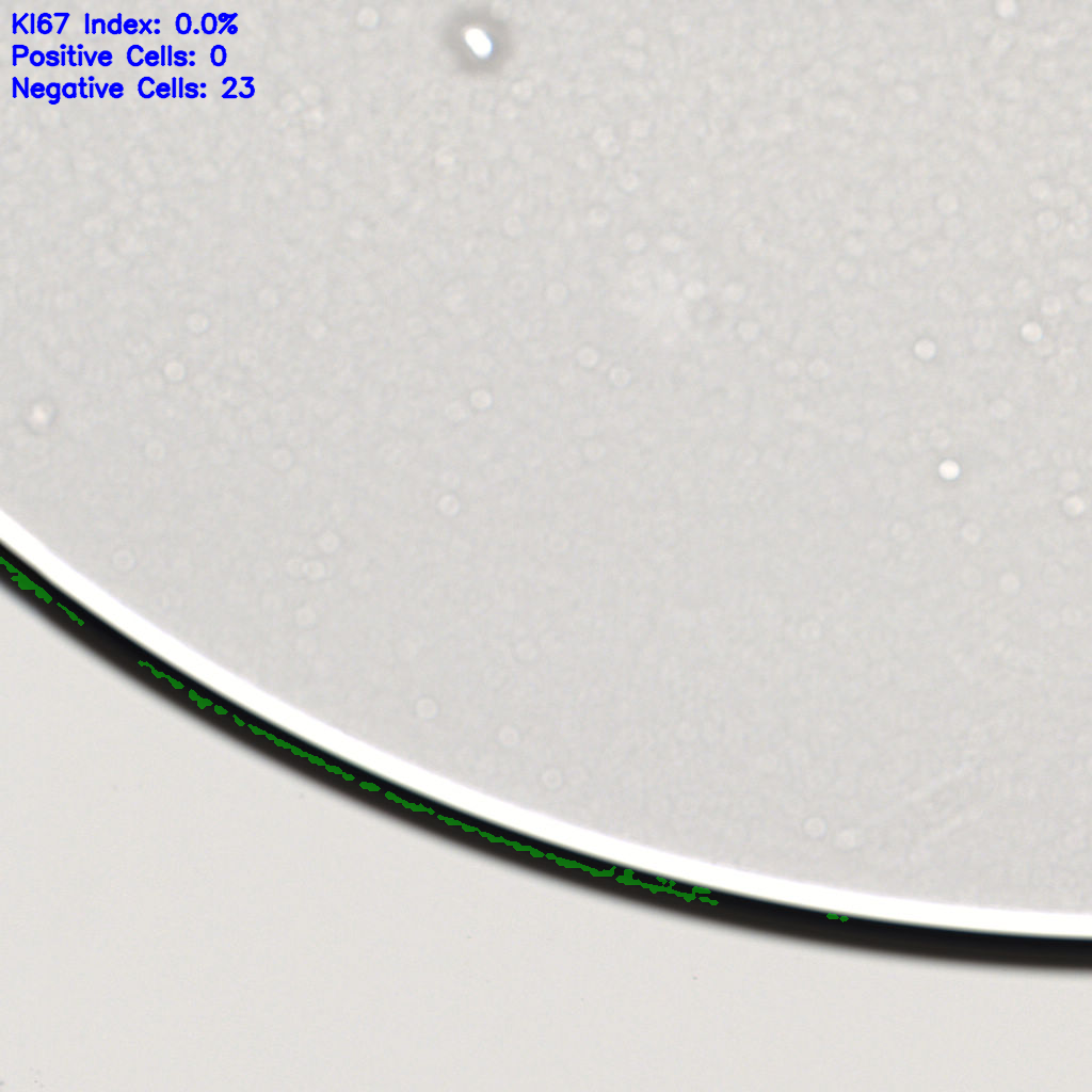 slice_60_10_x53760_y8960.png