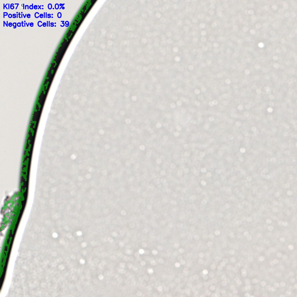 slice_60_7_x53760_y6272.png