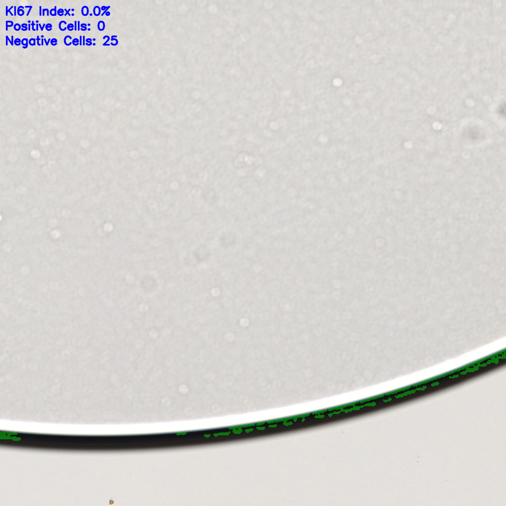 slice_61_10_x54656_y8960.png