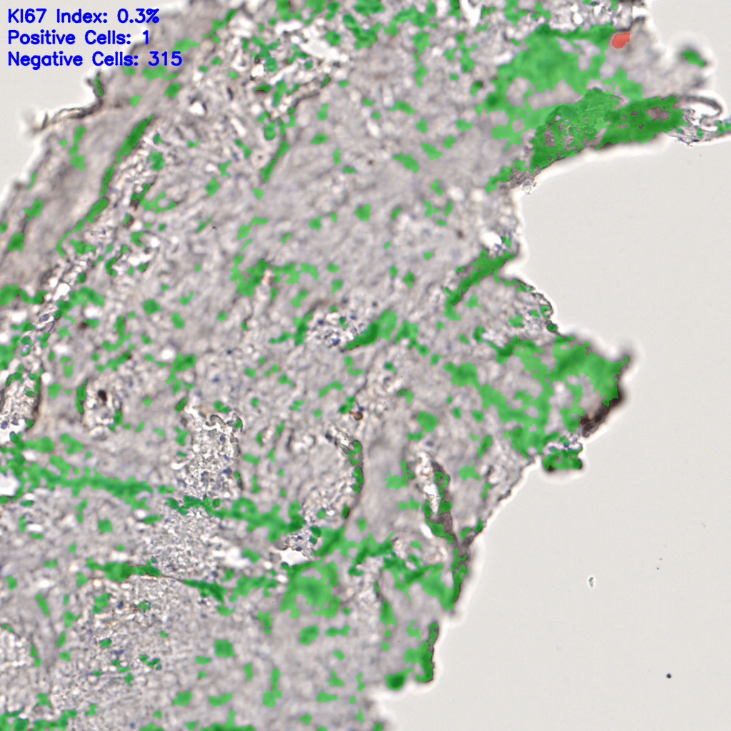 slice_61_16_x54656_y14336.png