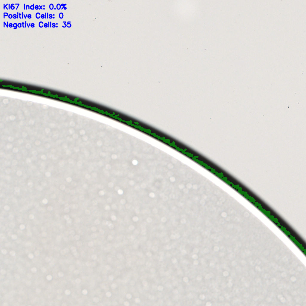 slice_62_6_x55552_y5376.png