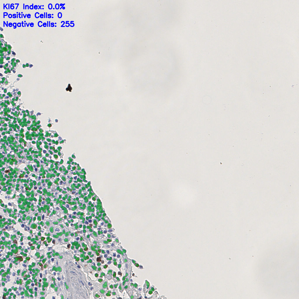 slice_6_11_x5376_y9856.png