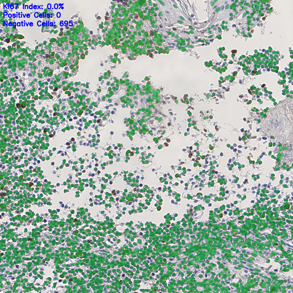 slice_6_13_x5376_y11648.png