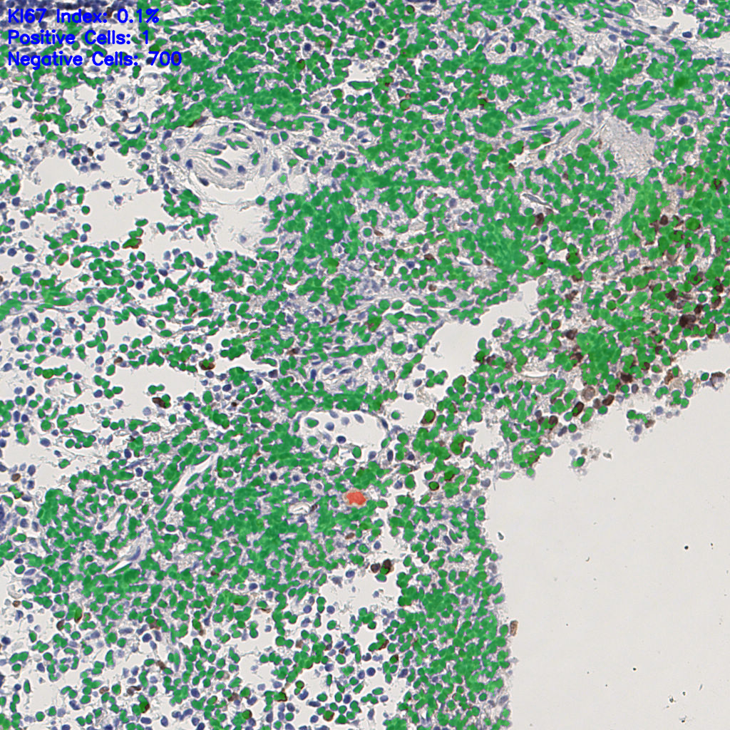 slice_6_14_x5376_y12544.png