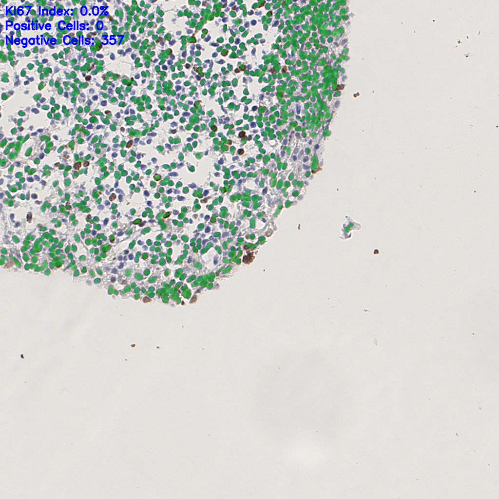 slice_6_15_x5376_y13440.png