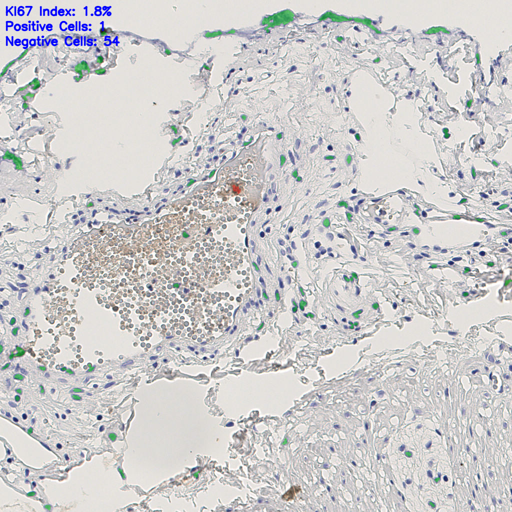 slice_6_19_x5376_y17024.png